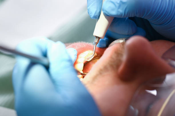 Best Root Canal Emergency Dentist  in Mountain Green, UT