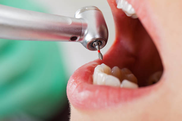 Best Broken Tooth Emergency  in Mountain Green, UT